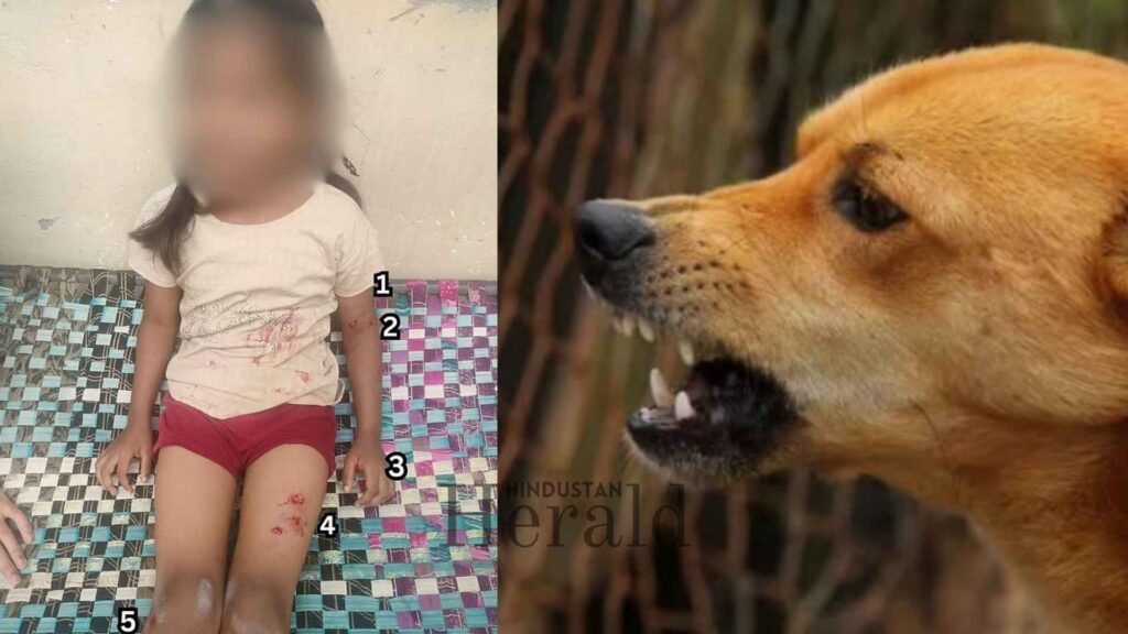 Stray Dog Attack 6-Year-Old Child